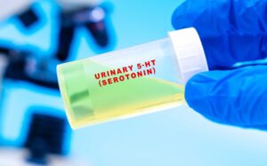 Measuring serotonin, serotonin and gut-brain axis, serotonin levels