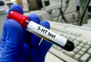 Measuring serotonin, where is serotonin made, serotonin testing