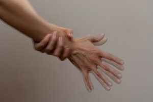 Parkinson-Krankheit und Serotonin, Parkinson-Tremor