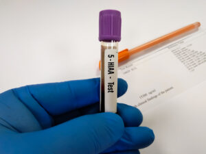 Serotonin-Untersuchung, Messung des Serotoninspiegels, Serotonin-Test, Untersuchung bei niedrigem Serotoninspiegel